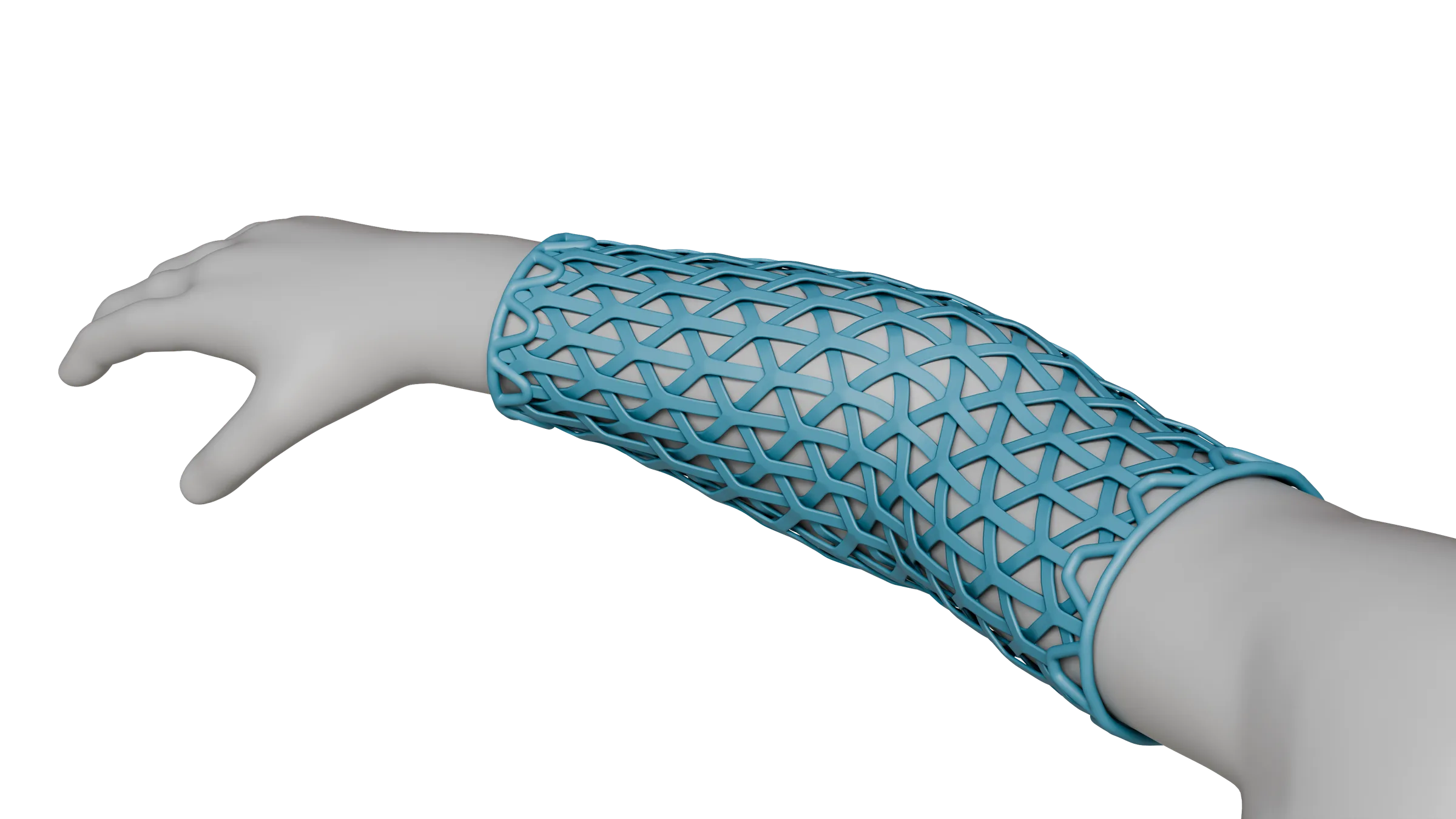 Breathable Arm Cast